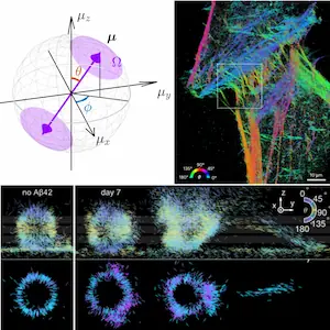 Single-molecule orientation-localization microscopy: Applications and approaches